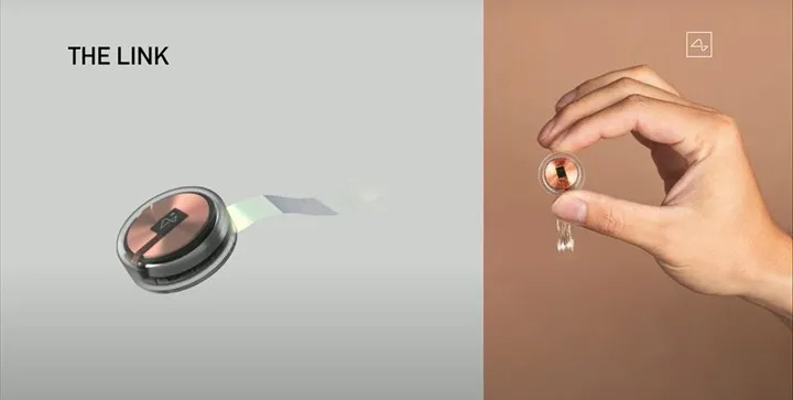 Neuralink'in İnsan Beyin Çipi İmplantında Yaşanan Sorunlar ve Son Durum