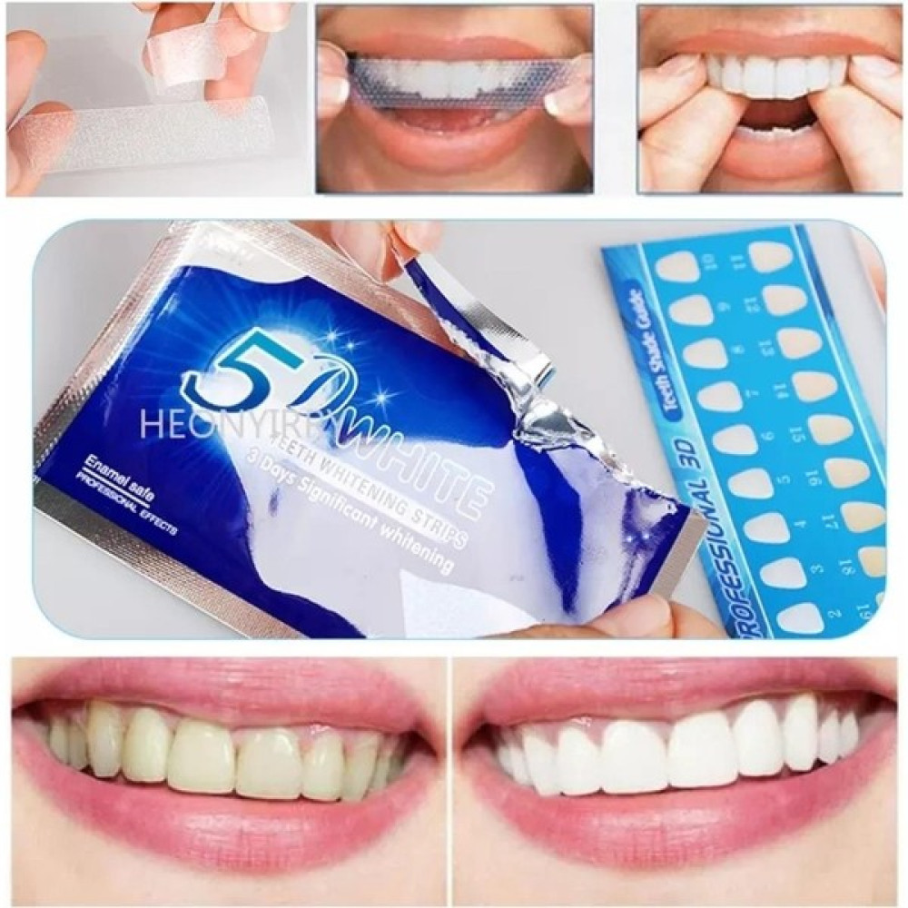 5d White 5d Diş Beyazlatma Bandı -Diş Beyazlatma Şeritleri (2 Li Paket ) 09886 Diş Beyazlatıcılar Fiyatı