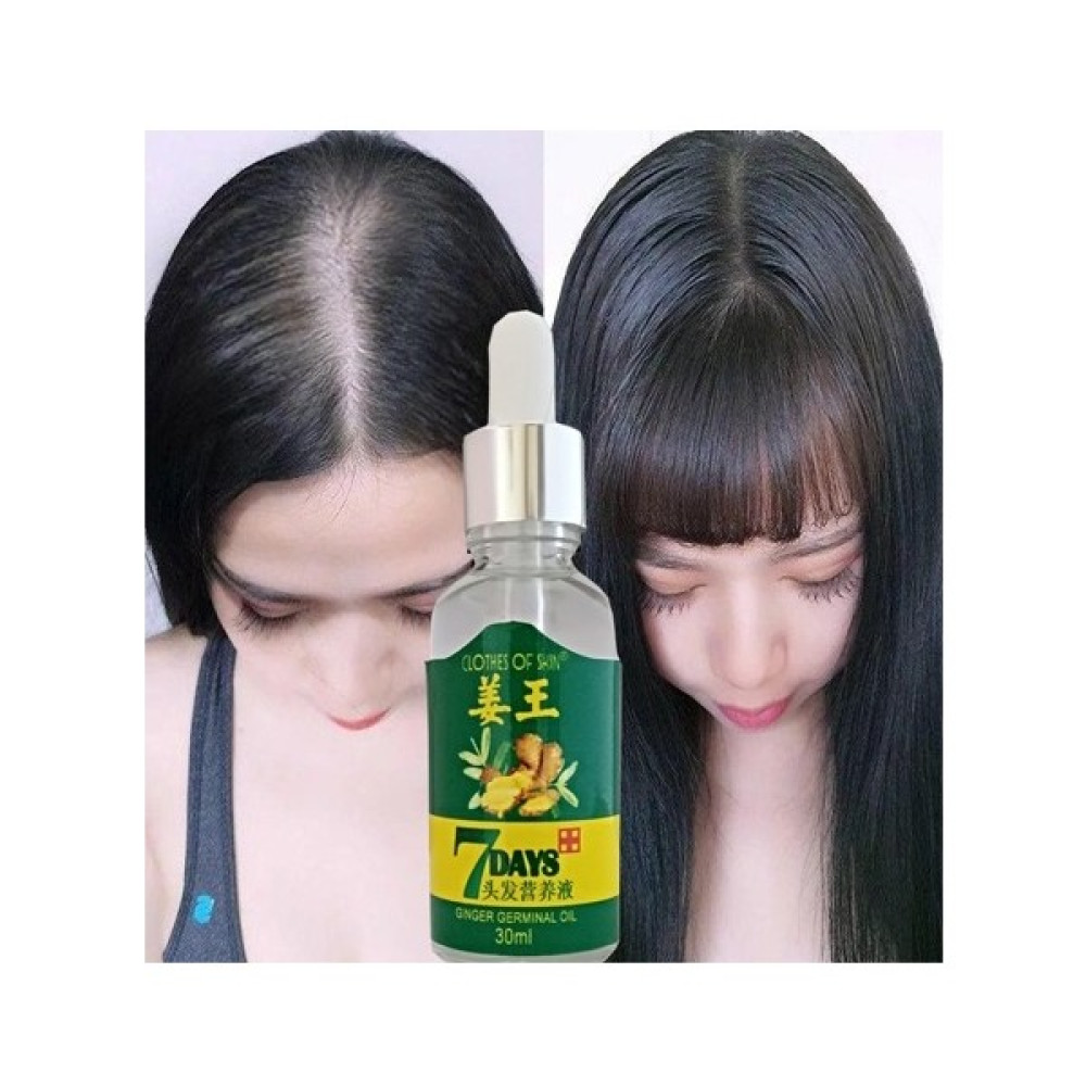 7Days 30ML Gingergerminalessentialoil Hair Growth Loss Treatment Serum Unisex 3 Adet Saç Bakım Yağı Oto Boyaları Fiyatı