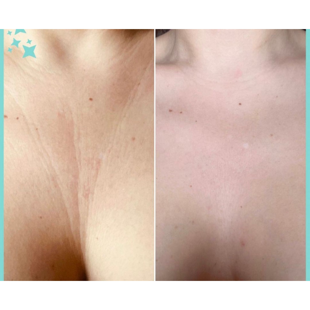 Biosmile Dekolte Kırışıklıklarını Önleyici Visco Yastık Standart Ebatlarda Pudra Renkli Orta Sertlik Diğer Fiyatı