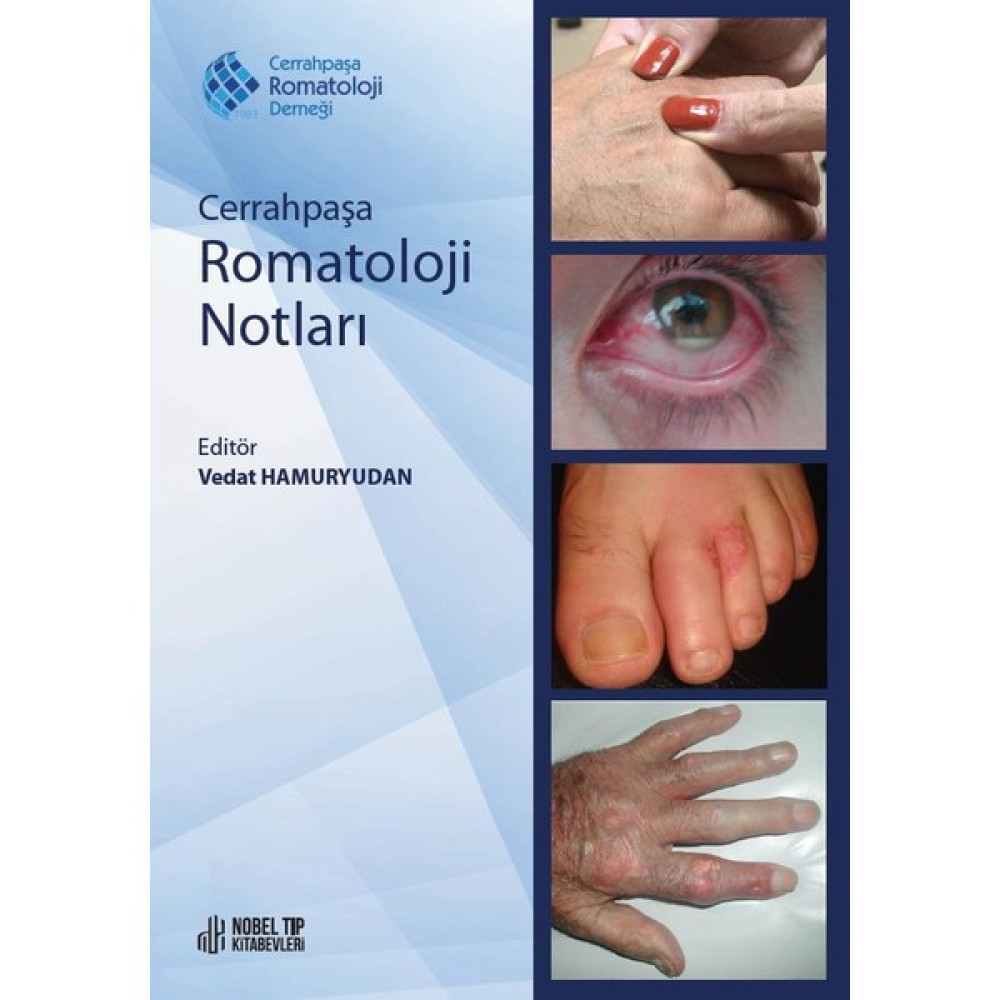 Cerrahpaşa Romatoloji Notları - Vedat Hamuryudan Tıp Kitapları Fiyatı