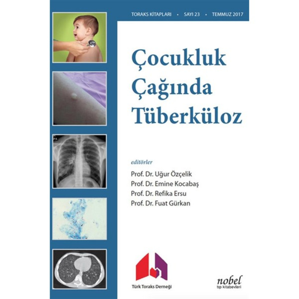 Çocukluk Çağında Tüberküloz Tanı: Tedavi ve Korumada Güncel Yaklaşımlar ve Olgu Örnekleri Tıp Kitapları Fiyatı