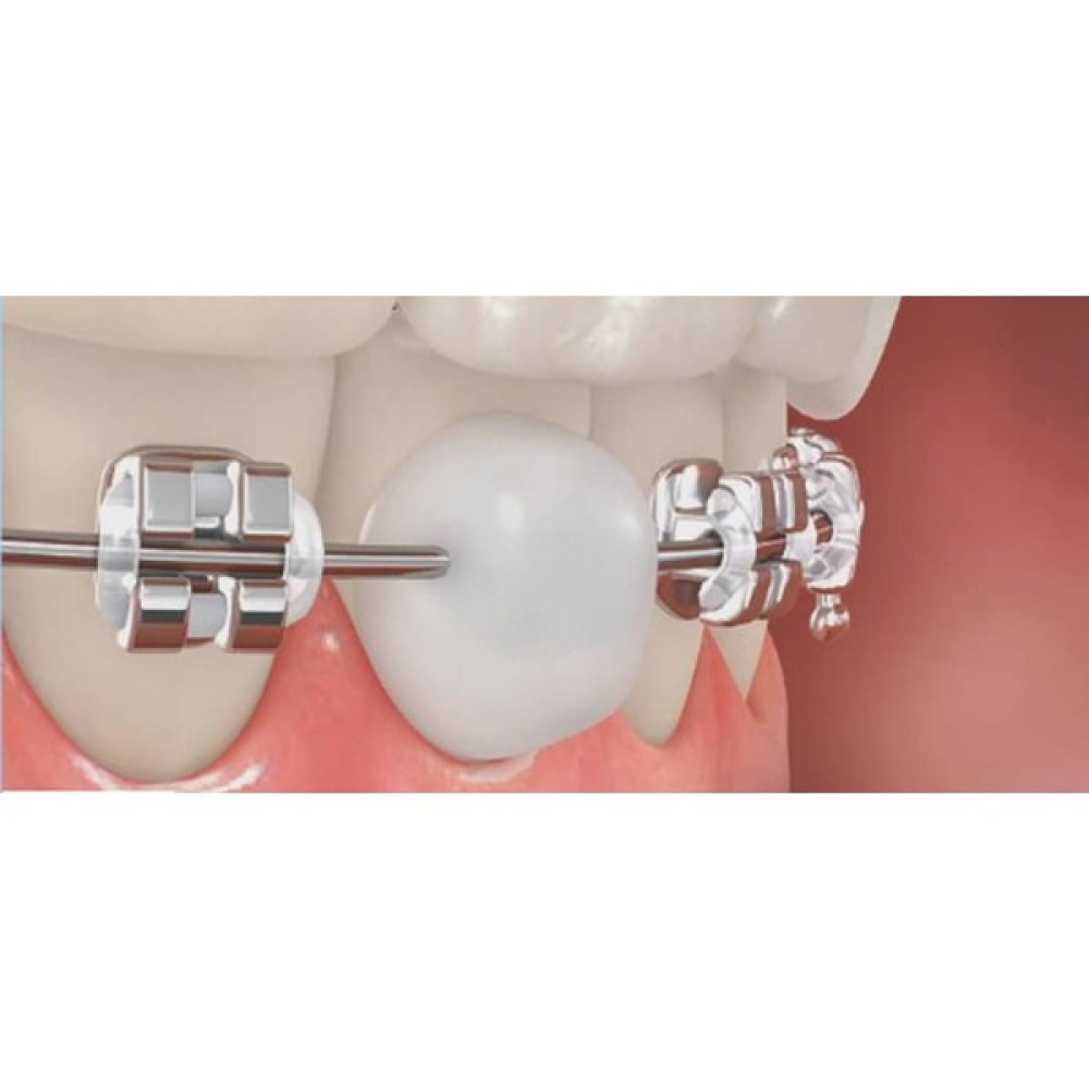 Dentalsepet Ortodonti Mumu - Diş Teli Mumu - Ortodontik Wax Diş Beyazlatıcılar Fiyatı
