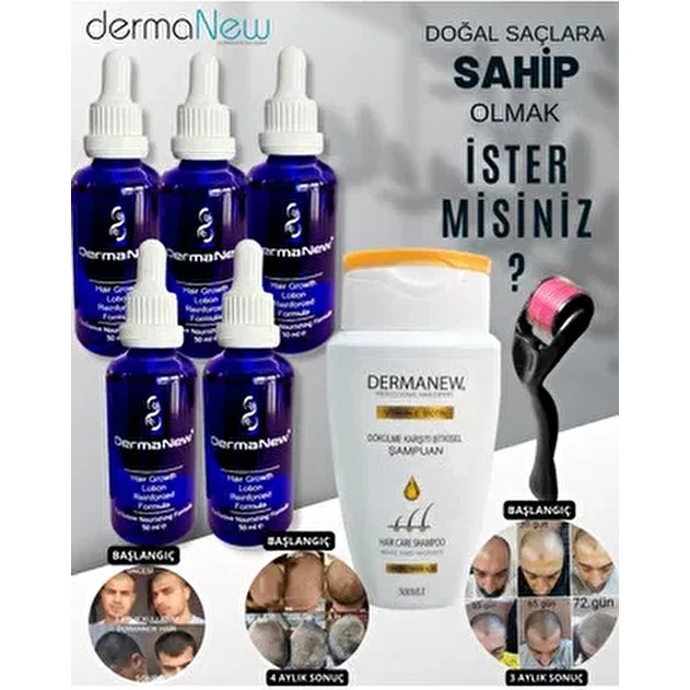 DermaNew Hair Dermanew 5 Adet 50 Ml Dökülme Karşıtı Saç Gürleştirici Serum Ve Şampuan Roller Hediyeli Diğer Fiyatı
