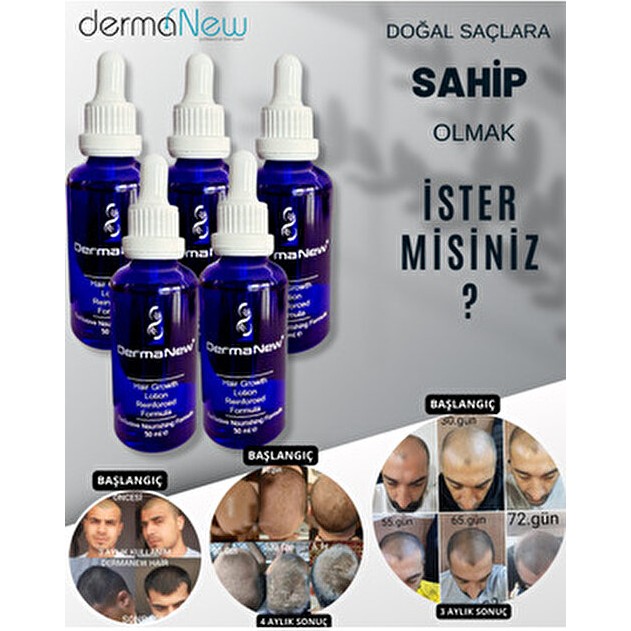 DermaNew Hair Dermanew Saç Uzatıcı Yağ Ve Serum 5 Adet Suya Dayanıklı Kadınlar İçin Özel Formül Diğer Fiyatı