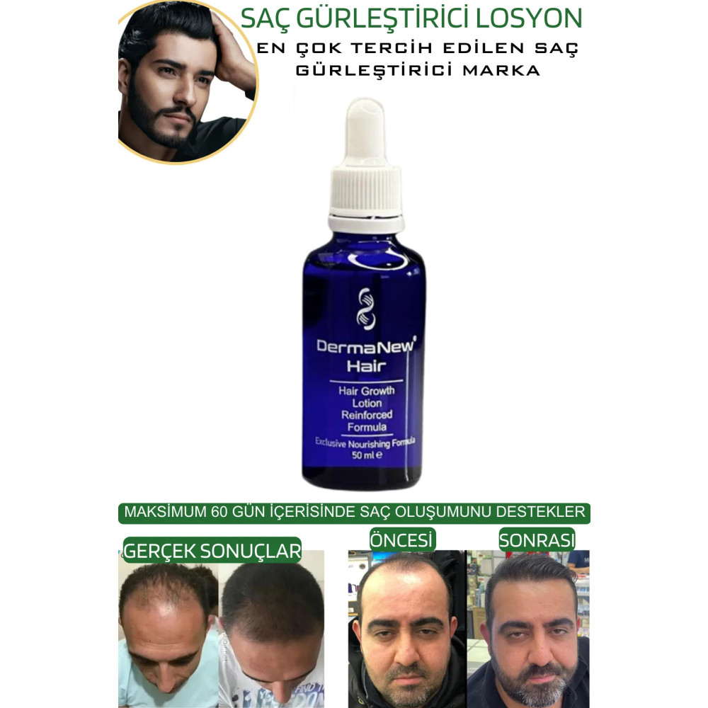 dermanew hair Saç Gürleştirici Losyon - Saç Çıkartıcı - Saç Ilacı Mavi Su / 2 Adet Serum Saç Bakım Maskeleri & Serumlar & Spreyler Fiyatı