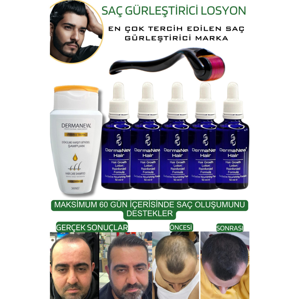 dermanew hair Saç Gürleştirici Serum Roller Mavi Şampuan Hediyeli / /5x50ml Saç Bakım Maskeleri & Serumlar & Spreyler Fiyatı