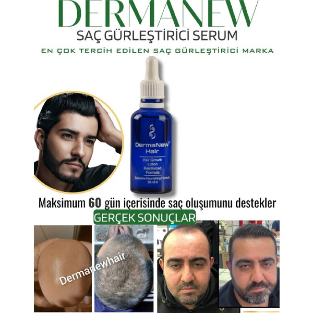 Dermanew Saç Gürleştirici Dermanew Hair Losyon / 1 Adet 1X50 ml Saç Şekillendirici Köpük Fiyatı