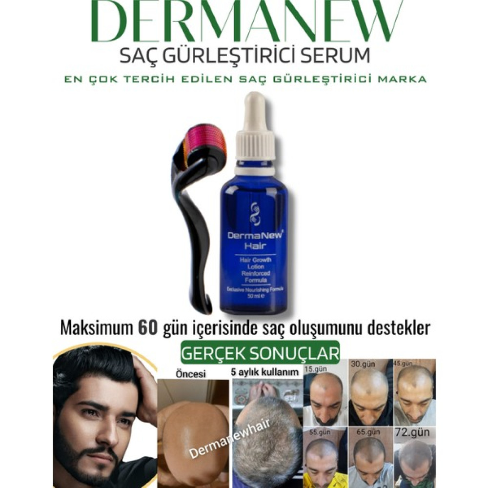 Dermanew Saç Gürleştirici Dermanew Hair Losyon / 1 Losyon +Roller 1X50 ml Saç Bakım Maskeleri & Serumlar & Spreyler Fiyatı