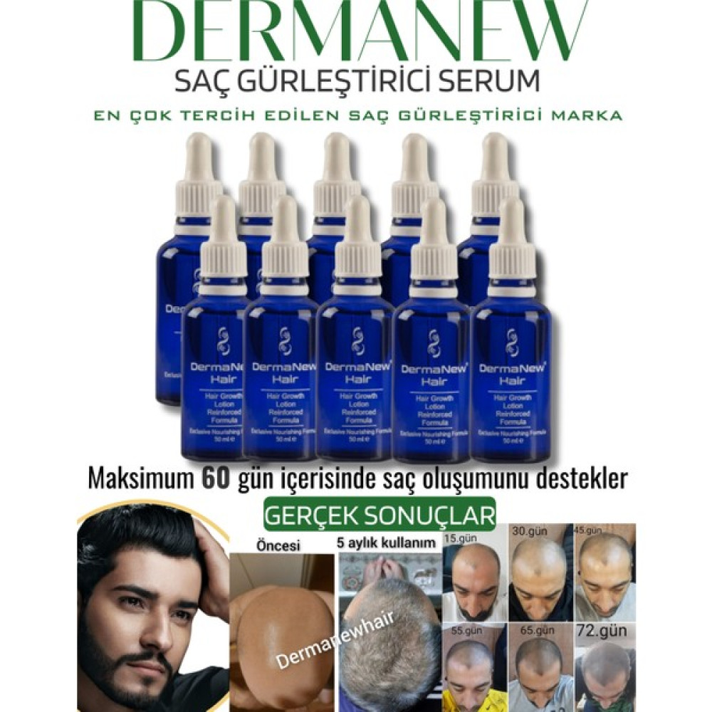 Dermanew Saç Gürleştirici Dermanew Hair Losyon / 10 Losyon Saç Bakım Maskeleri & Serumlar & Spreyler Fiyatı
