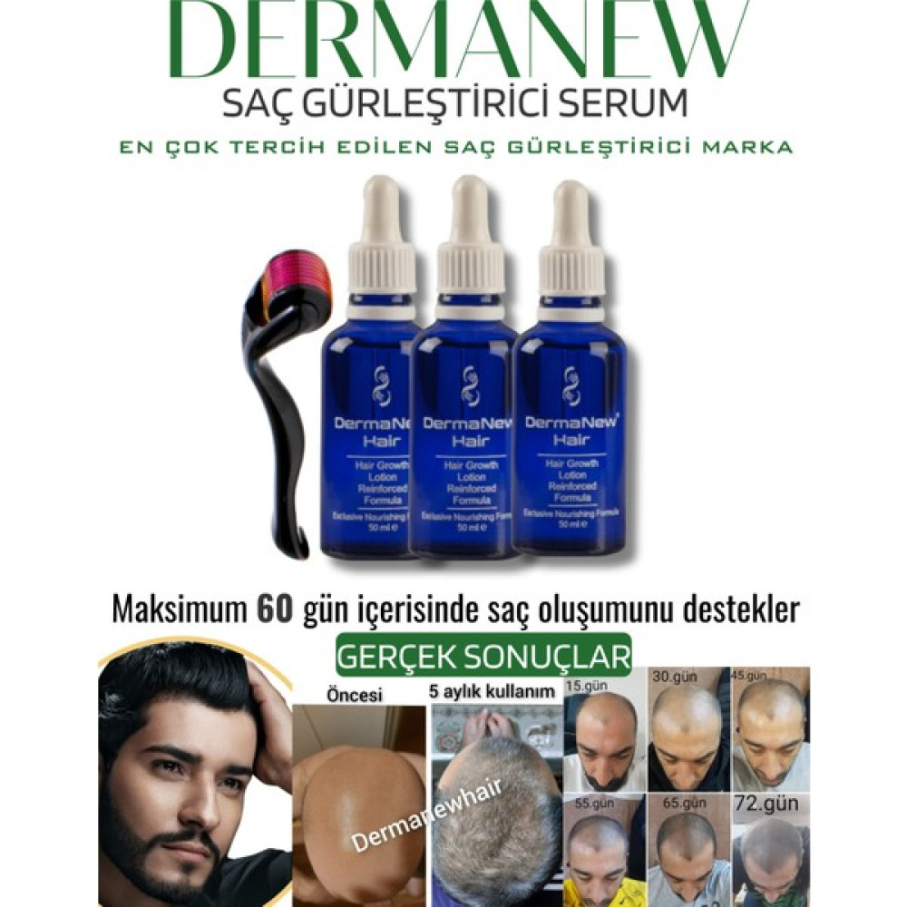 Dermanew Saç Gürleştirici Dermanew Hair Losyon / 3 Losyon +Roller Saç Bakım Maskeleri & Serumlar & Spreyler Fiyatı