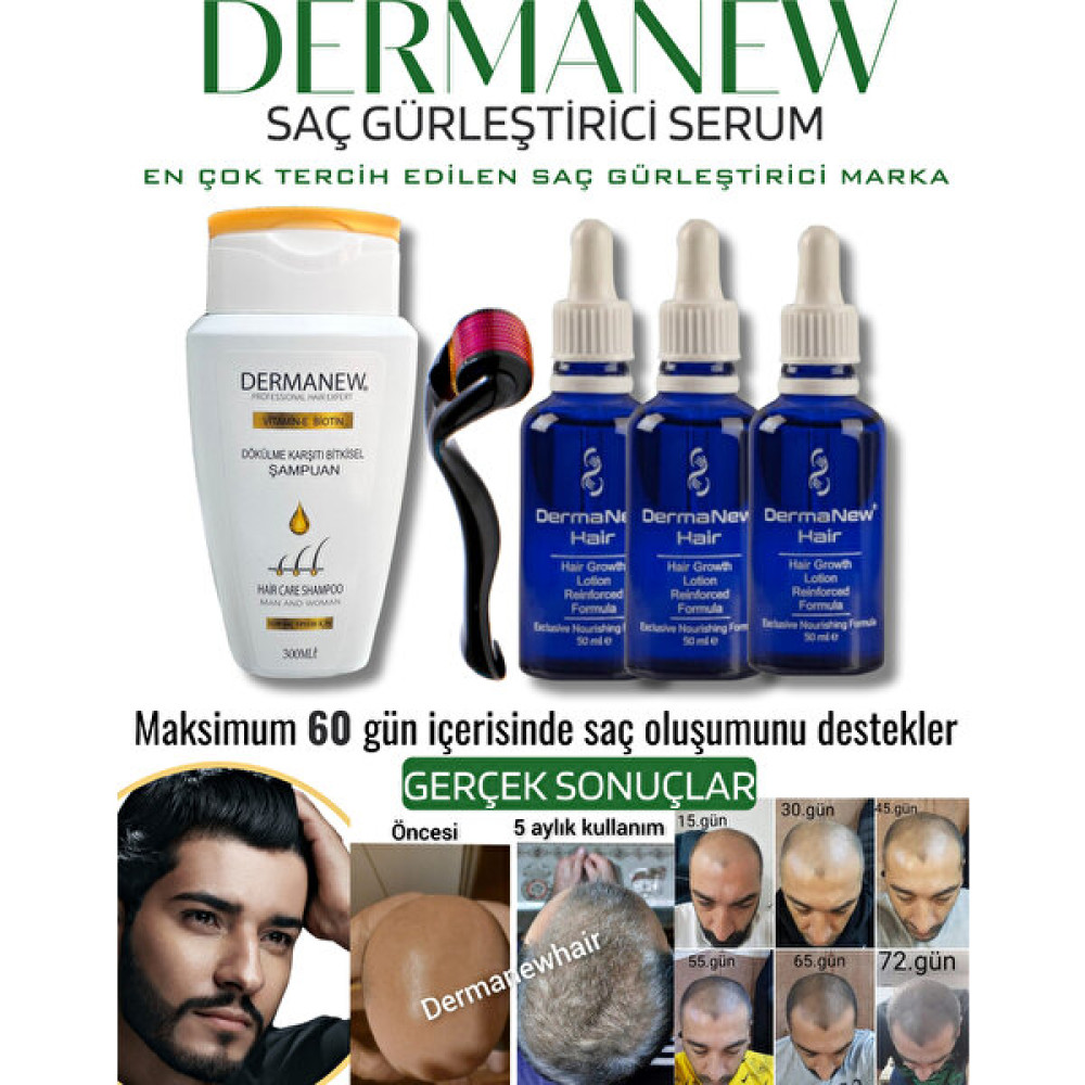 Dermanew Saç Gürleştirici Dermanew Hair Losyon / 3 Losyon +Roller +Şampuan Saç Bakım Maskeleri & Serumlar & Spreyler Fiyatı