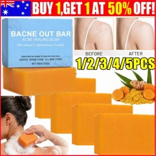 5x Bacne Out Bar, Body Acne Cleansing-Soap with Turmeric VitaminC & Alphaarbutin Soaps price