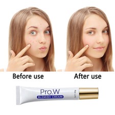 Pro.W Blemish Cream Anti Acne Scars Dark Spots Removal Skin Whitening 30ML Blemish Cream price