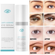 My Perfect Eyes Anti-ageing Eye Serum Lines Reduces Wrinkles for Dark Circles Anti-Ageing price