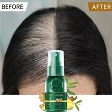 New Hair Growth Spray Serum Ginger Anti Hair Loss Fast Grow Essence Care Product Hair Loss Products price