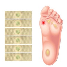 12pcs Foot Corn-Callus Removal Clavus Paster Corn Pads Foot Care Products Useful Foot Care price