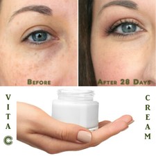 Matrixyl 3000 Peptide Hyaluronic Acid Retinol Collagen AntiAging Vitamin C Cream Day Creams price
