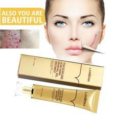 Best Scar removal Cream Skin Care for Scars Reduce Surgery Acne Stretch Marks Stretch Mark Prevention and Removal price