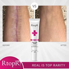 Scar Removal Cream Gel, Anti Acne Skin Repair Acne Treatment Fade Stretch Mark Stretch Mark Prevention and Removal price