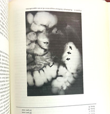 Organ Transplantation The Surgical Clinics of North America Lot of 2 Books 1976 Medical Books price
