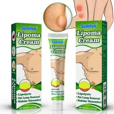 Lipomas Cream Antibacterial Cleansing Cellulite Fat Lump Removal Cellulite Prevention and Removal price