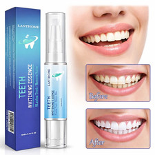 Zahnaufhellung Gelstift extra stark weiß Zahnaufheller zarter Fleckenentferner Teeth Whiteners price