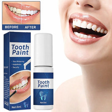 Zahnaufhellungsgel Zahnfarbkorrektor Fleckenentfernung Whitening Gel Mundpflege Teeth Whiteners price