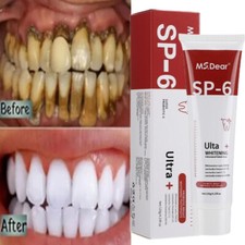 Probiotics Whiten Teeth Toothpaste Breath Removal Clean Toothpaste for Teeth Toothpastes price