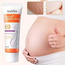 Crema de eliminación de cicatrices de 40 g para cicatrices antiguas crema de eliminación de estrías reparación rápida Stretch Mark Prevention y Removal price