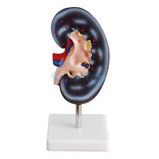 2X Modelo Médico Anatómico Riñón Derecho Humano Tamaño Natural Sobre la Base Medical Derecho price