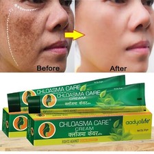 Hyperpigmentation, élimination des imperfections Crème à base de plantes... Stretch Mark Prevention et Removal price