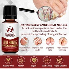 Mejor Tratamiento Para Los Hongos En Las Uñas De Los Pies Dedos Cura Hongos Cura Foot price