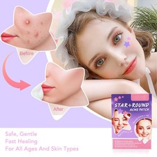 Adesivo brufolo cartone animato 126 pezzi carino ed efficace per trattamento acne tendenza Cura Acne e Pimple price