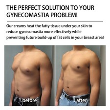 *Ginecomastia Crema Zenzero Rassodante 30ml Ginecomastia Riduzione Cellulite Crea Cellulite Prevention e Removal price