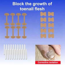 Professional Ingrown Toenail Foot Corrector Stickers Set Toe Nail Care Pedicure Foot Verzorging price