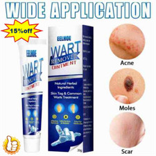 Instant Blemish Removal Gel Body Warts  Remover Treatment Cream Skin Tags Care 1 Blemish Cream price