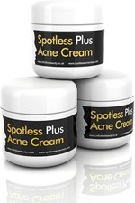 Spotless Plus Acne Cream Spots Blemish Blackhead Whitehead Treatment Tub 50g Blemish Cream price