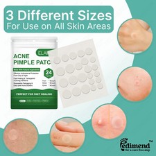 Hydrocolloid Acne Pimple Patches for Fast Healing & Blemish, Face Skin Care - UK Acne en Pimple Verzorging price