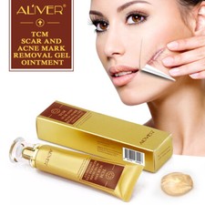 ALIVER Acne Scar Removal Cream Gel Ointment Stretch Cut Burn Spot Mark Treatment Blemish Cream price