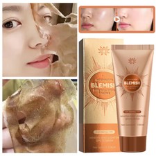 1-6pcs Herbal Spots Peel-Off Facial Mask for Deep Cleansing Acne Treatment Spot Skin Cleansing and Peeling price