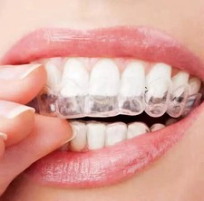 2pcs Teeth Whitening Mouth Trays For Bleaching Thermo Gum Shield Teeth Grinding Teeth Whiteners price