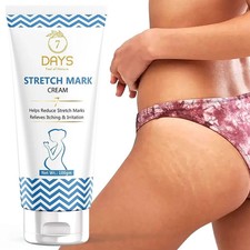 7 Days Stretch Mark Removal Cream 100gm With Long Expiry & Free Shipping Stretch Mark Prevention and Removal price