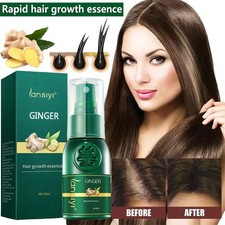 Hair Growth Spray Serum Ginger Anti Hair Loss Fast Grow Essence Care Product Hair Loss Products price