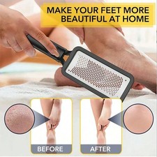 Foot Rasp File Pedicure Callus Remover Hard Dead Skin Scrubber Tool Feet Care US Foot Care price