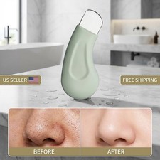 Blackhead & Whitehead Removal Tool – Acne Extractor Facial Scraper For Skin Care Acne and Pimple Care price