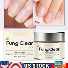 Nail Care Cream, Toenail Nail Repair for Damaged Cracked, Strength & Nail Growth Nail Care Cream price