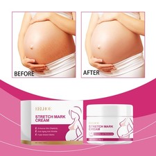 Postpartum Skin Care Cream – Moisturizing Stretch Mark Relief for Moms Postpartum Stretch Mark Cream price