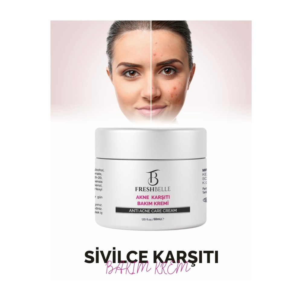 FreshBelle Sivilce Giderici Ve Akne Siyah Nokta Giderici Krem 50 ml Cilt ve Yüz Bakımı Fiyatı