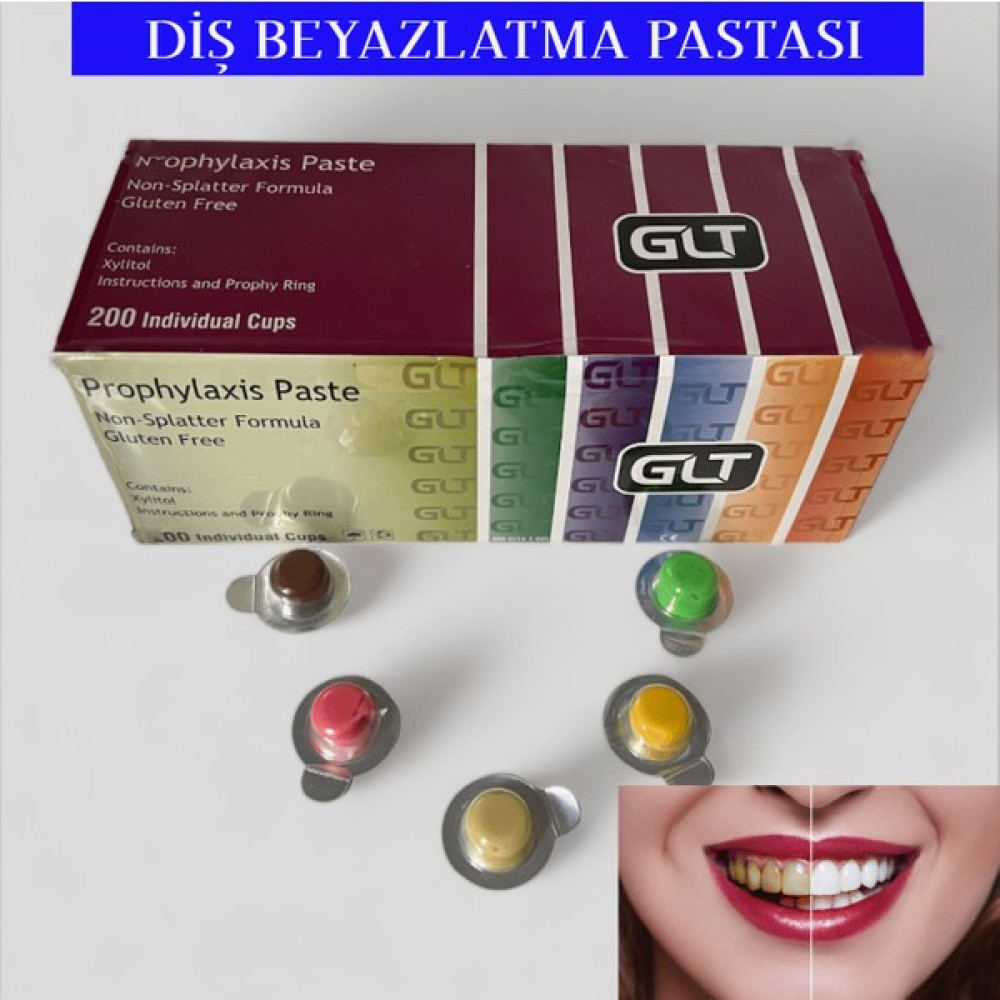 Glt Diş Beyazlatma Pastası 10 Adet Diş Beyazlatıcılar Fiyatı